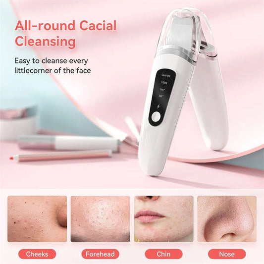 Ultrasonic Skin Scrubber & Blackhead Remover